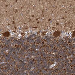 Invitrogen ACOT7 Polyclonal Antibody 100 &mu;L; Unconjugated:Antibodies,