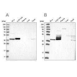 Invitrogen ACOT7 Polyclonal Antibody 100 &mu;L; Unconjugated:Antibodies,