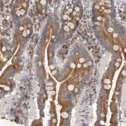 Invitrogen EDEM3 Polyclonal Antibody 100 &mu;L; Unconjugated:Antibodies,