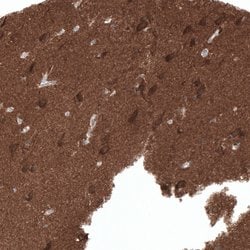 Invitrogen ACOT7 Polyclonal Antibody 100 &mu;L; Unconjugated:Antibodies,