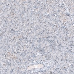 Invitrogen ACOT7 Polyclonal Antibody 100 &mu;L; Unconjugated:Antibodies,