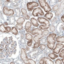 Invitrogen ACOT7 Polyclonal Antibody 100 &mu;L; Unconjugated:Antibodies,