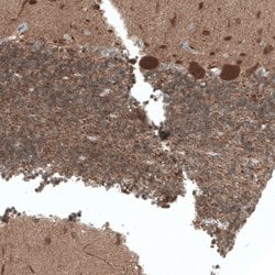 Invitrogen ACOT7 Polyclonal Antibody 100 &mu;L; Unconjugated:Antibodies,