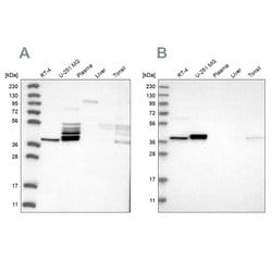 Invitrogen ACOT7 Polyclonal Antibody 100 &mu;L; Unconjugated:Antibodies,