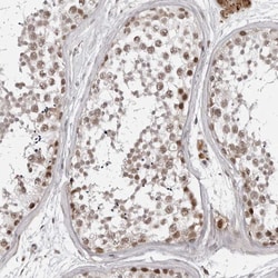 Invitrogen PHF3 Polyclonal Antibody 100 &mu;L; Unconjugated:Antibodies,