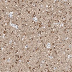 Invitrogen TMEM242 Polyclonal Antibody 100 &mu;L; Unconjugated:Antibodies,