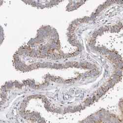 Invitrogen ELP3 Polyclonal Antibody 100 &mu;L; Unconjugated:Antibodies,