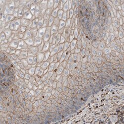 Invitrogen USP34 Polyclonal Antibody 100 &mu;L | Buy Online | Invitrogen&trade; | Fisher Scientific