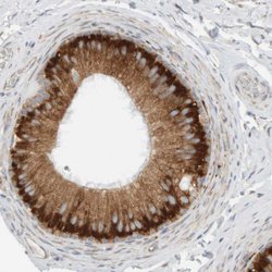 Invitrogen Ribophorin II Polyclonal Antibody 100 &mu;L; Unconjugated:Anticuerpos