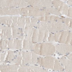 Invitrogen Ribophorin II Polyclonal Antibody 100 &mu;L; Unconjugated:Anticuerpos