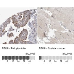 Invitrogen PEX6 Polyclonal Antibody 100 &mu;L | Buy Online | Invitrogen&trade; | Fisher Scientific