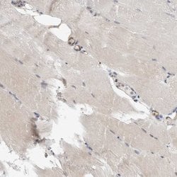 Invitrogen PEX6 Polyclonal Antibody 100 &mu;L | Buy Online | Invitrogen&trade; | Fisher Scientific