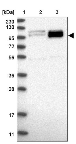Invitrogen PEX6 Polyclonal Antibody 100 &mu;L | Buy Online | Invitrogen&trade; | Fisher Scientific