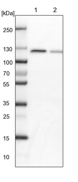 Invitrogen PEX6 Polyclonal Antibody 100 &mu;L | Buy Online | Invitrogen&trade; | Fisher Scientific