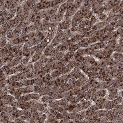 Invitrogen RSU1 Polyclonal Antibody 100 &mu;L | Buy Online | Invitrogen&trade; | Fisher Scientific