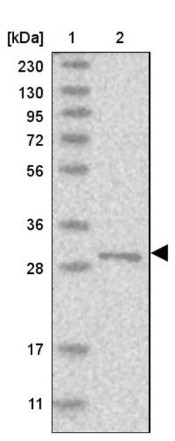 Invitrogen RSU1 Polyclonal Antibody 100 &mu;L | Buy Online | Invitrogen&trade; | Fisher Scientific