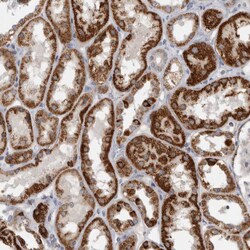 Invitrogen RAB18 Polyclonal Antibody 100 &mu;L; Unconjugated:Antibodies,