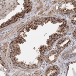 Invitrogen RAB18 Polyclonal Antibody 100 &mu;L; Unconjugated:Antibodies,