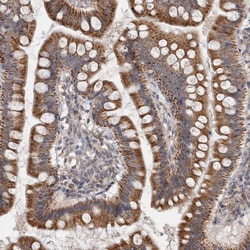 Invitrogen RAB18 Polyclonal Antibody 100 &mu;L; Unconjugated:Antibodies,