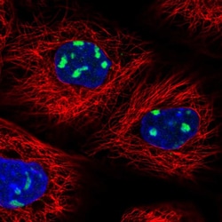 Invitrogen UTP6 Polyclonal Antibody 100 &mu;L; Unconjugated:Antibodies,