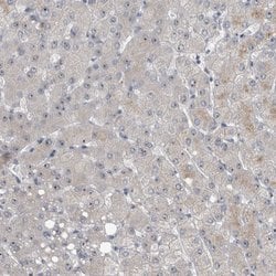Invitrogen UTP6 Polyclonal Antibody 100 &mu;L; Unconjugated:Antibodies,