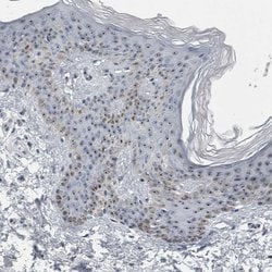 Invitrogen UTP6 Polyclonal Antibody 100 &mu;L; Unconjugated:Antibodies,