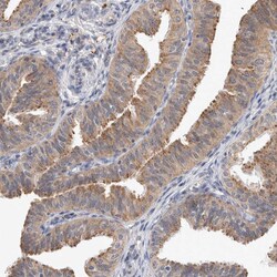 Invitrogen MRPL37 Polyclonal Antibody 100 &mu;L; Unconjugated:Antibodies,