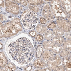 Invitrogen MRPL37 Polyclonal Antibody 100 &mu;L; Unconjugated:Antibodies,