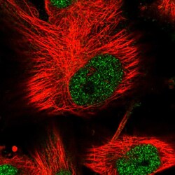 Invitrogen PHF15 Polyclonal Antibody 100 &mu;L; Unconjugated:Antibodies,
