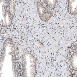 Invitrogen PHF15 Polyclonal Antibody 100 &mu;L; Unconjugated:Antibodies,