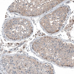 Invitrogen PHF15 Polyclonal Antibody 100 &mu;L; Unconjugated:Antibodies,