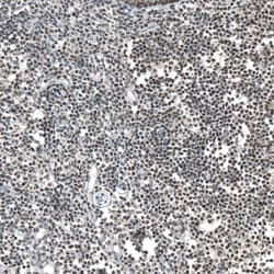 Invitrogen PHF15 Polyclonal Antibody 100 &mu;L; Unconjugated:Antibodies,