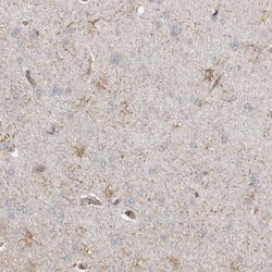 Invitrogen REPS2 Polyclonal Antibody 100 &mu;L | Buy Online | Invitrogen&trade; | Fisher Scientific