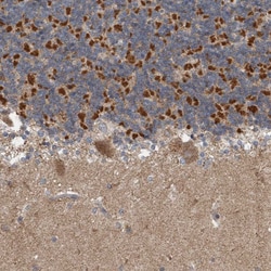 Invitrogen ARMC1 Polyclonal Antibody 100 &mu;L; Unconjugated:Antibodies,