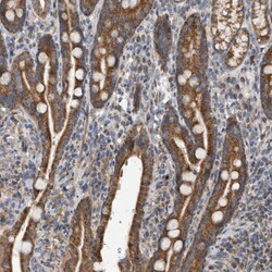 Invitrogen ARMC1 Polyclonal Antibody 100 &mu;L; Unconjugated:Antibodies,