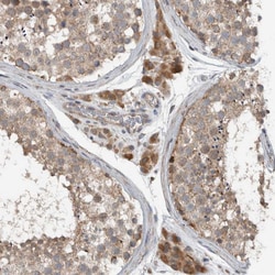 Invitrogen ARMC1 Polyclonal Antibody 100 &mu;L; Unconjugated:Antibodies,
