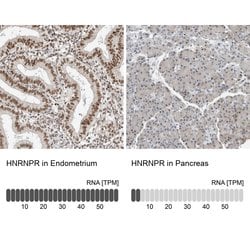 Invitrogen hnRNP R Polyclonal Antibody 100 &mu;L; Unconjugated:Antibodies,
