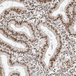 Invitrogen hnRNP R Polyclonal Antibody 100 &mu;L; Unconjugated:Antibodies,