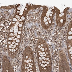 Invitrogen&trade;&nbsp;DNAJC8 Polyclonal Antibody