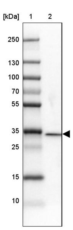 Invitrogen DNAJC8 Polyclonal Antibody 100 &mu;L | Buy Online | Invitrogen&trade; | Fisher Scientific