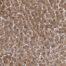 Invitrogen ALDH8A1 Polyclonal Antibody 100 &mu;L | Buy Online | Invitrogen&trade; | Fisher Scientific