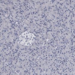 Invitrogen ALDH8A1 Polyclonal Antibody 100 &mu;L | Buy Online | Invitrogen&trade; | Fisher Scientific