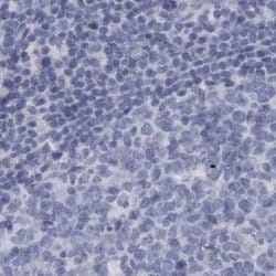 Invitrogen ALDH8A1 Polyclonal Antibody 100 &mu;L | Buy Online | Invitrogen&trade; | Fisher Scientific