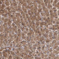 Invitrogen ALDH8A1 Polyclonal Antibody 100 &mu;L | Buy Online | Invitrogen&trade; | Fisher Scientific