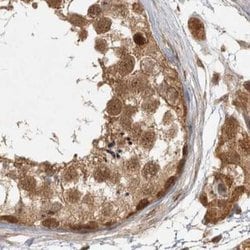 Invitrogen CAMSAP2 Polyclonal Antibody 100 &mu;L; Unconjugated:Antibodies,