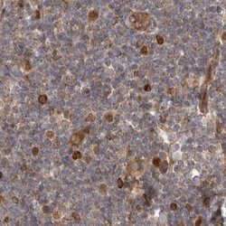 Invitrogen CAMSAP2 Polyclonal Antibody 100 &mu;L; Unconjugated:Antibodies,