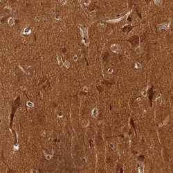 Invitrogen CAMSAP2 Polyclonal Antibody 100 &mu;L; Unconjugated:Antibodies,