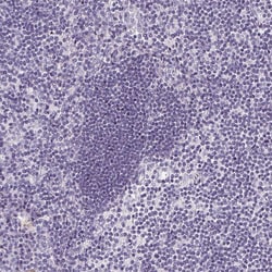 Invitrogen GSDMC Polyclonal Antibody 100 &mu;L; Unconjugated:Antibodies,