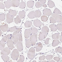 Invitrogen GSDMC Polyclonal Antibody 100 &mu;L; Unconjugated:Antibodies,
