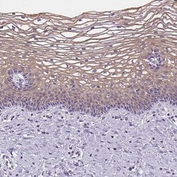 Invitrogen GSDMC Polyclonal Antibody 100 &mu;L; Unconjugated:Antibodies,